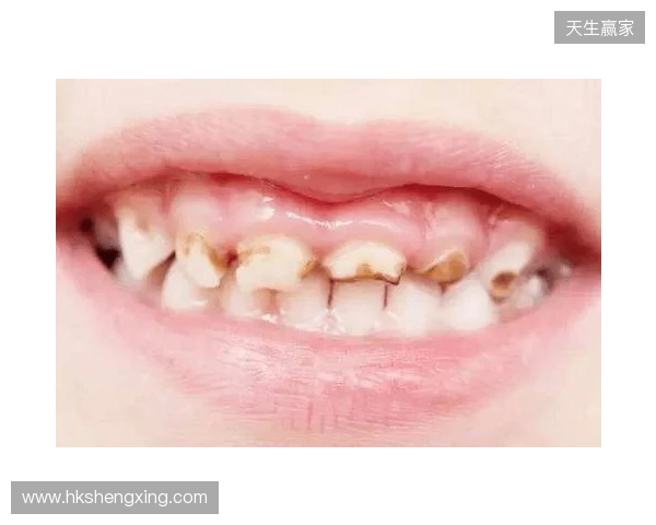 韦林顿确诊上唇部贯通伤;11、21牙半脱位;上颌前牙区牙槽骨骨折